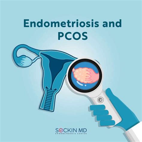 pcos and endometriosis specialist near me